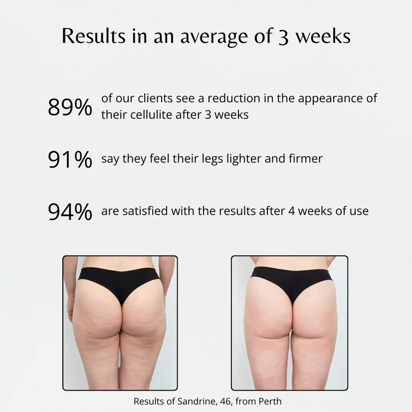 Leggings 3D / Black - Image 3