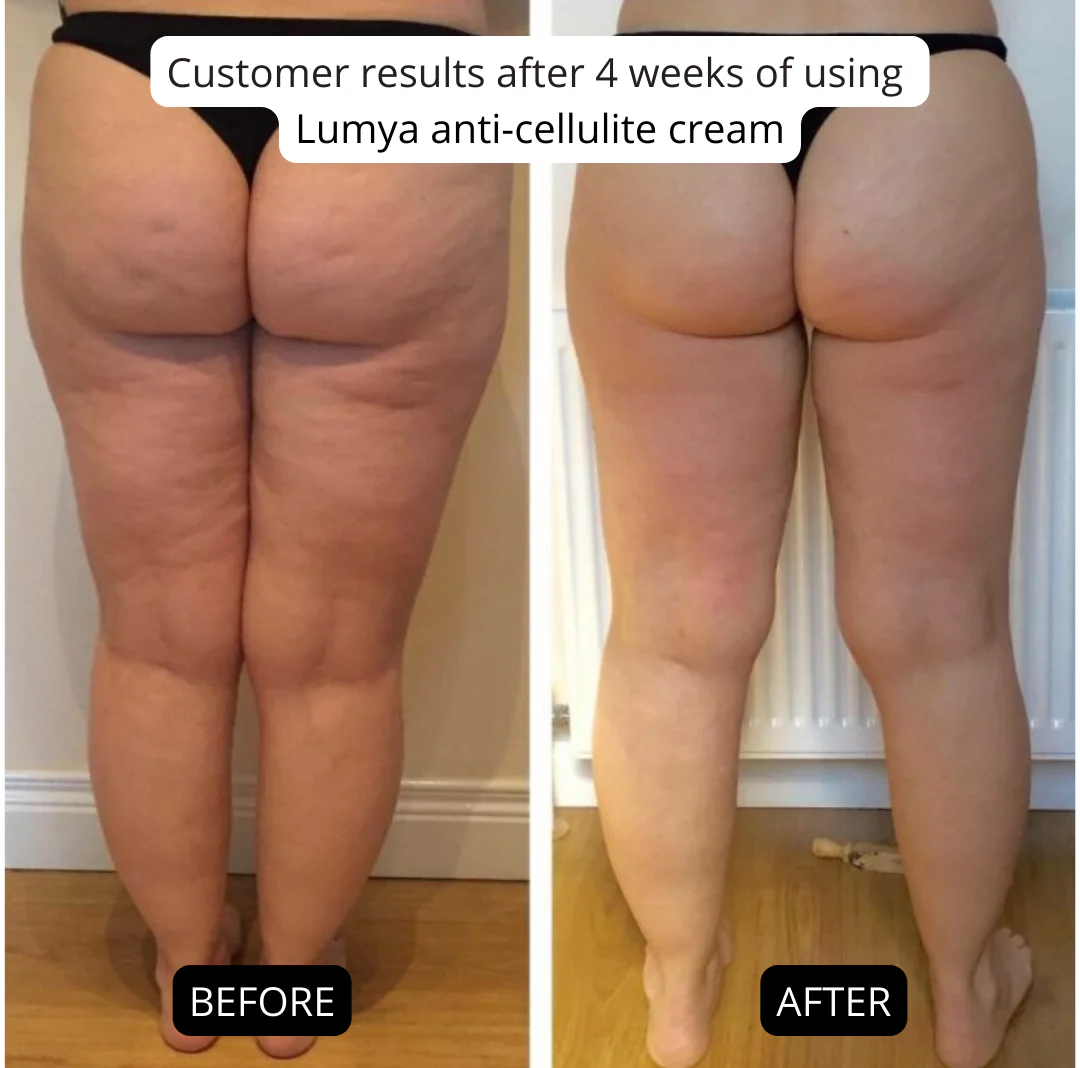 Anti-Cellulite Cream - Image 4