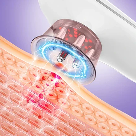 Cellulite Massager - Image 4