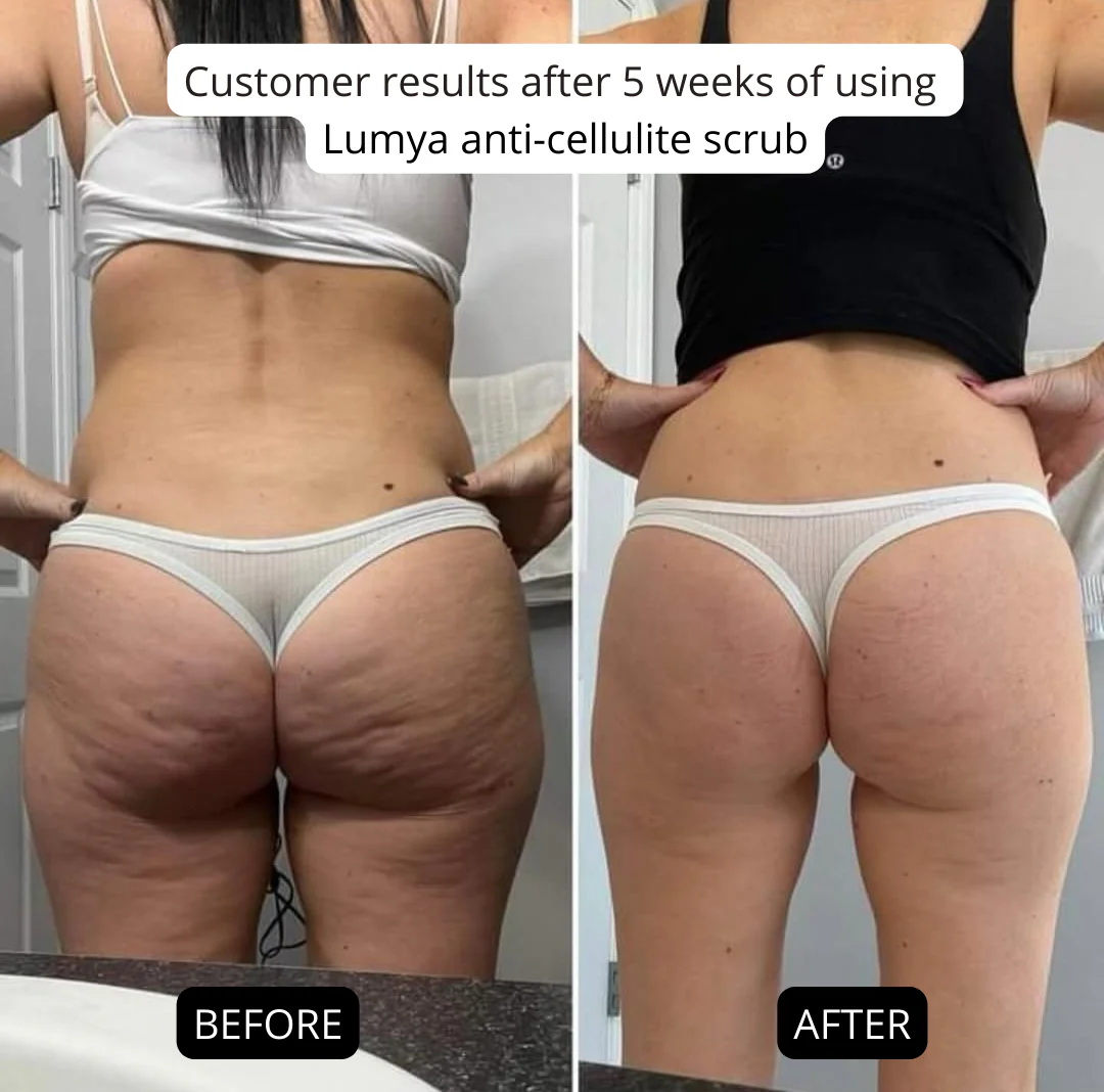 Anti-cellulite Salt Scrub - Image 4